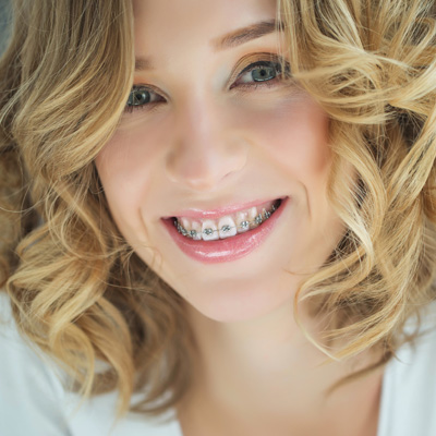 Melinda Marino, DDS Family and Cosmetic Dentistry | Dental Fillings, Short-Term Orthodontics and Veneers